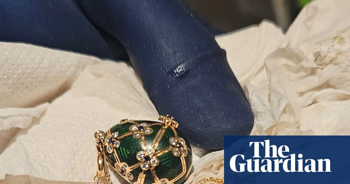 Patient police say they have recovered Fabergé pendant from man accused of swallowing it