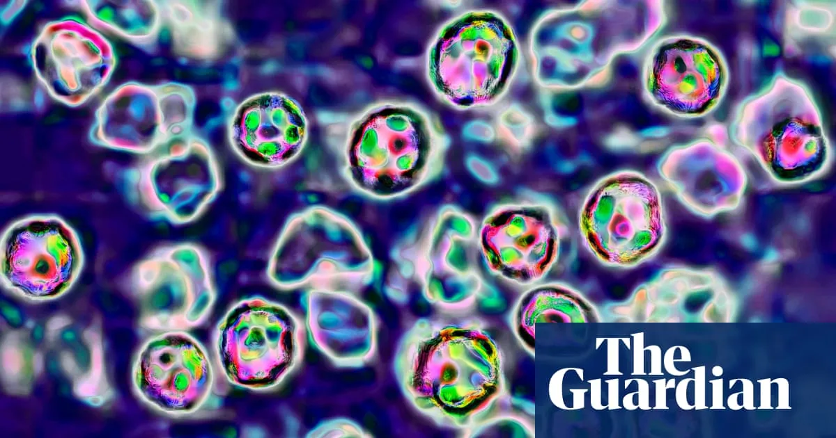 Two unvaccinated people die of measles in Pennsylvania
