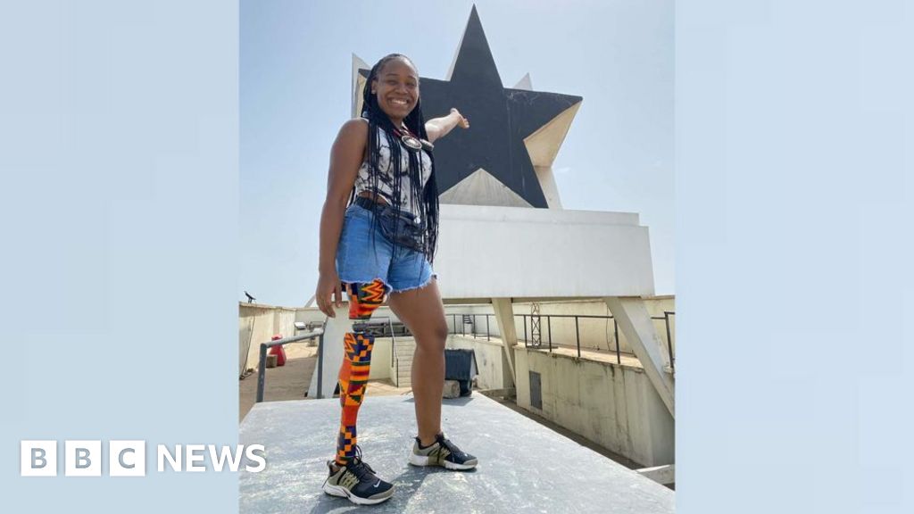 'My prosthetic leg represents my love for this country'