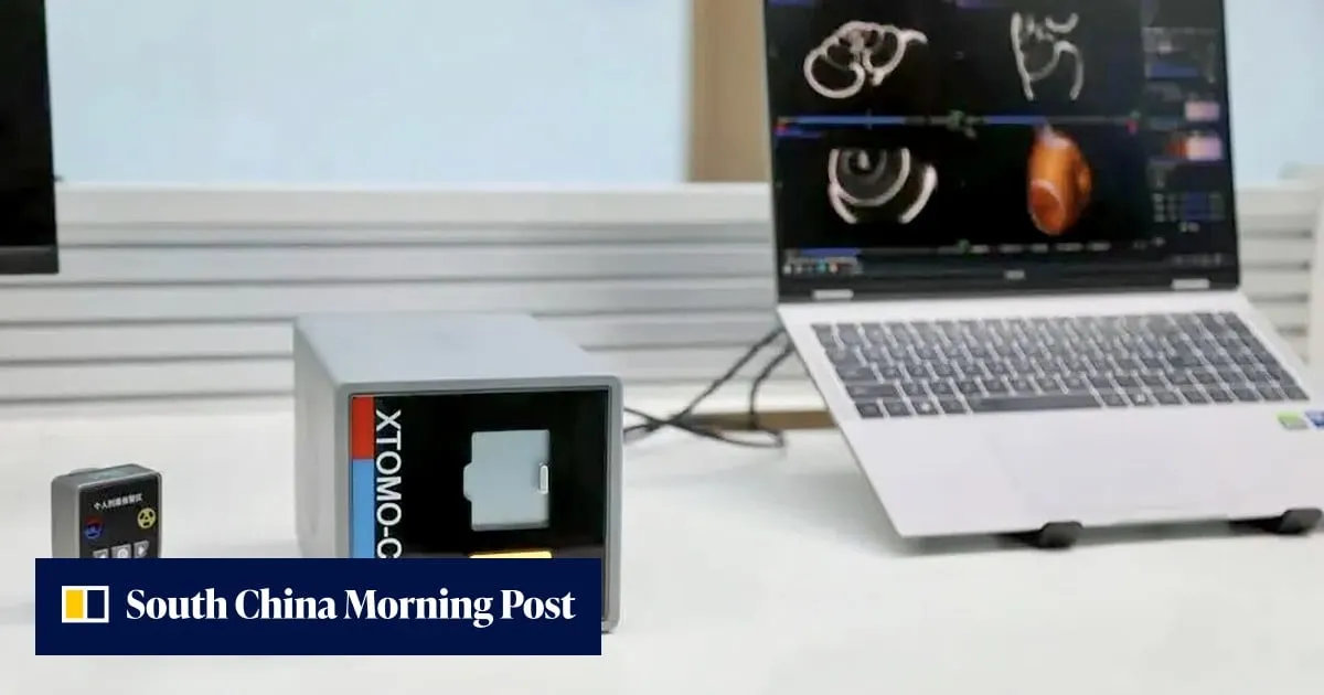Chinese scientists build world’s smallest CT scanner, weighing just 6kg