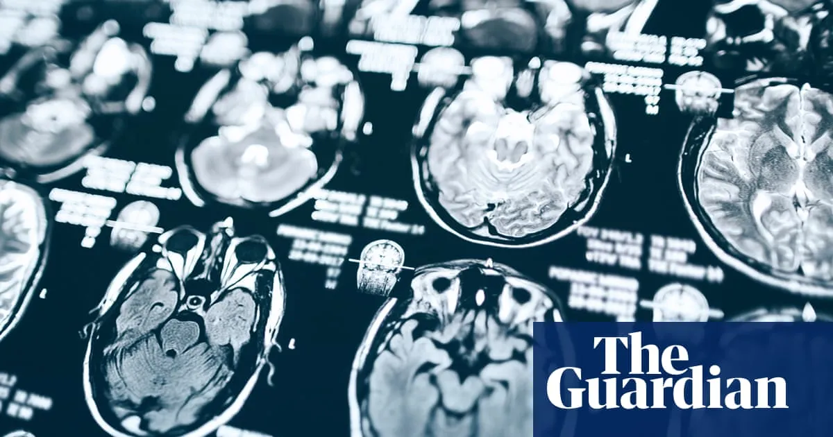 Hundreds of ageing Americans may not get results of Alzheimer’s study due to Trump cuts