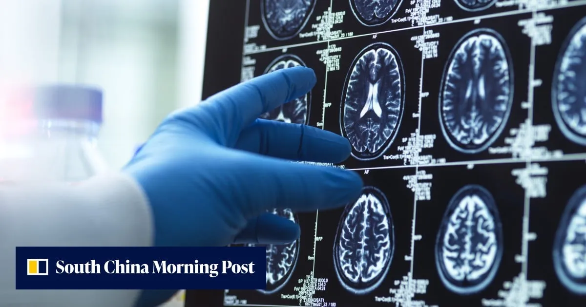 Japanese surgeon removes healthy brain tissue, leaving woman on ventilator