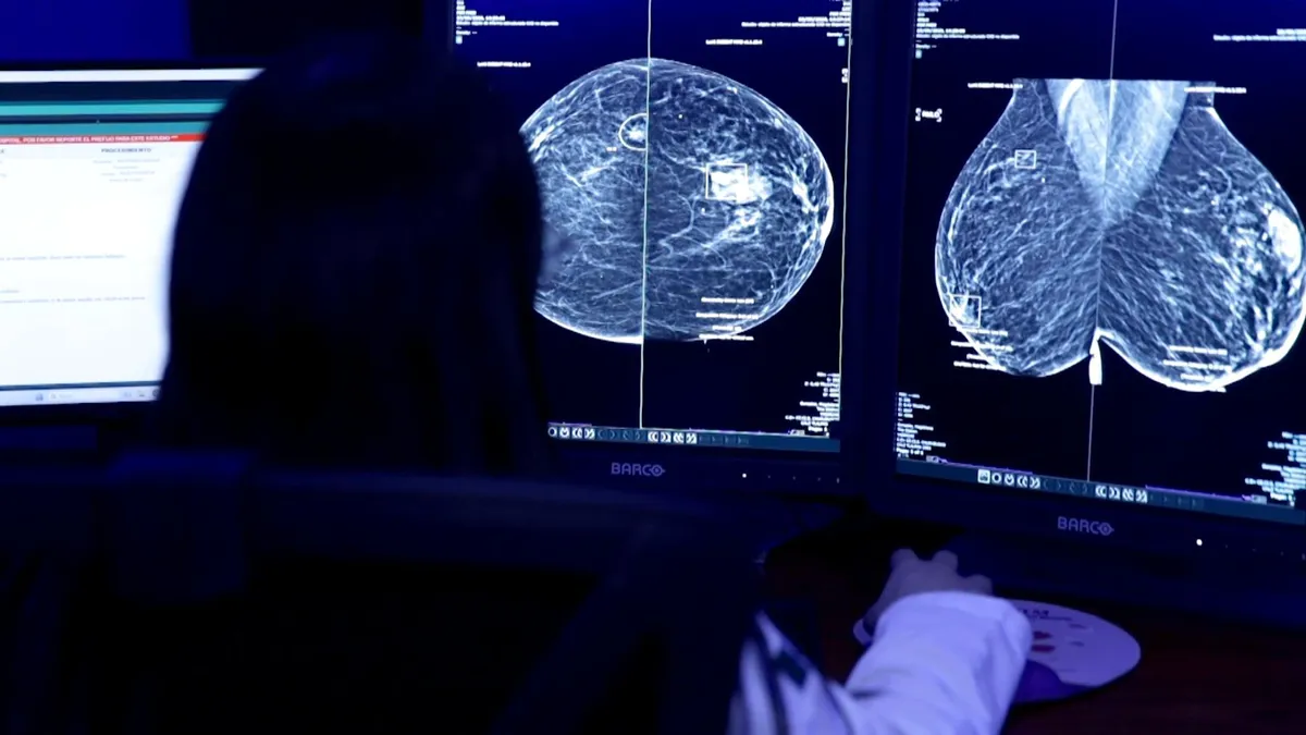 How AI is helping Mexico detect breast cancer earlier