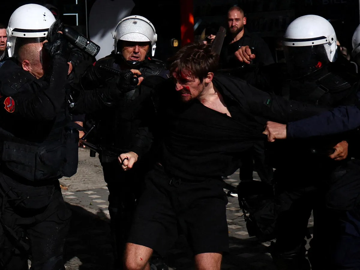 Photos: Student protest in Albania prompts violent clashes with police