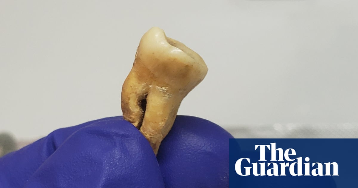 Mass grave in Jordan sheds new light on world’s earliest recorded pandemic