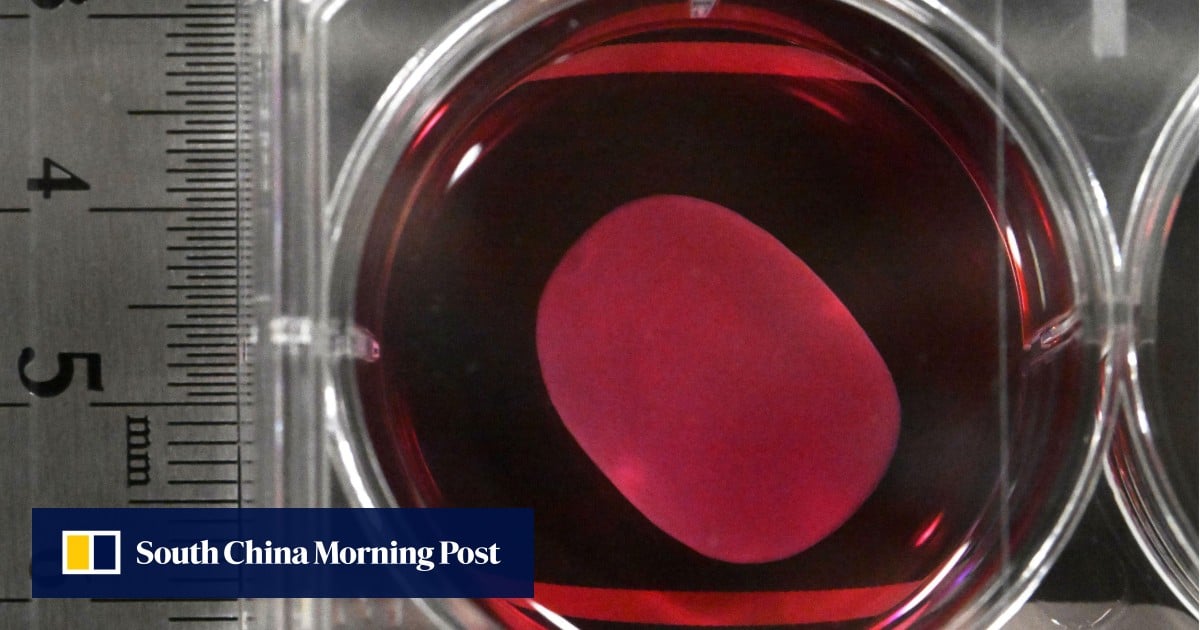 Japan approves world’s first regenerative medicines using iPS cells