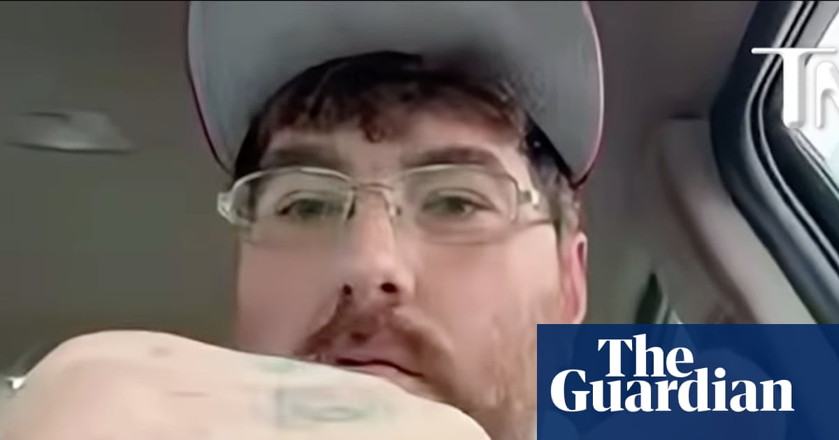 US man issues challenge to disprove his claim of having world’s smallest penis to raise micropenis awareness