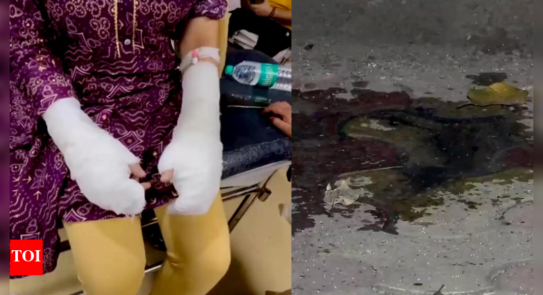 'Kept screaming, no one stopped to help': DU student attacked with acid; suspects on the run