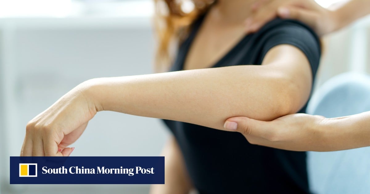 Funding cuts trigger calls for help on jobs from Hong Kong’s physiotherapists