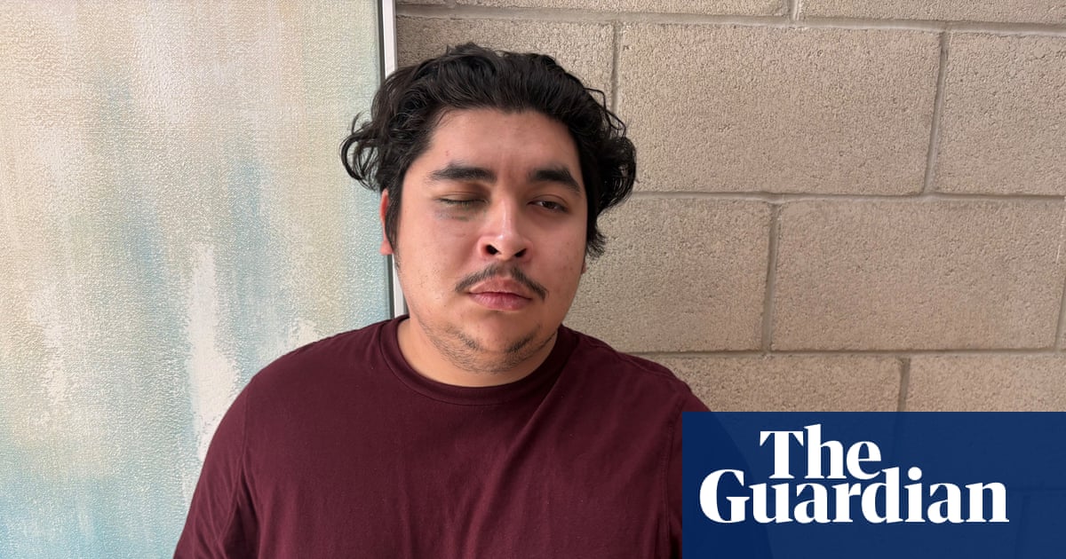 Los Angeles man blinded by officer’s projectile at anti-ICE protest, claim says