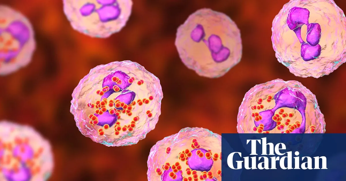 Experts consider expanding meningitis vaccine eligibility after Kent outbreak