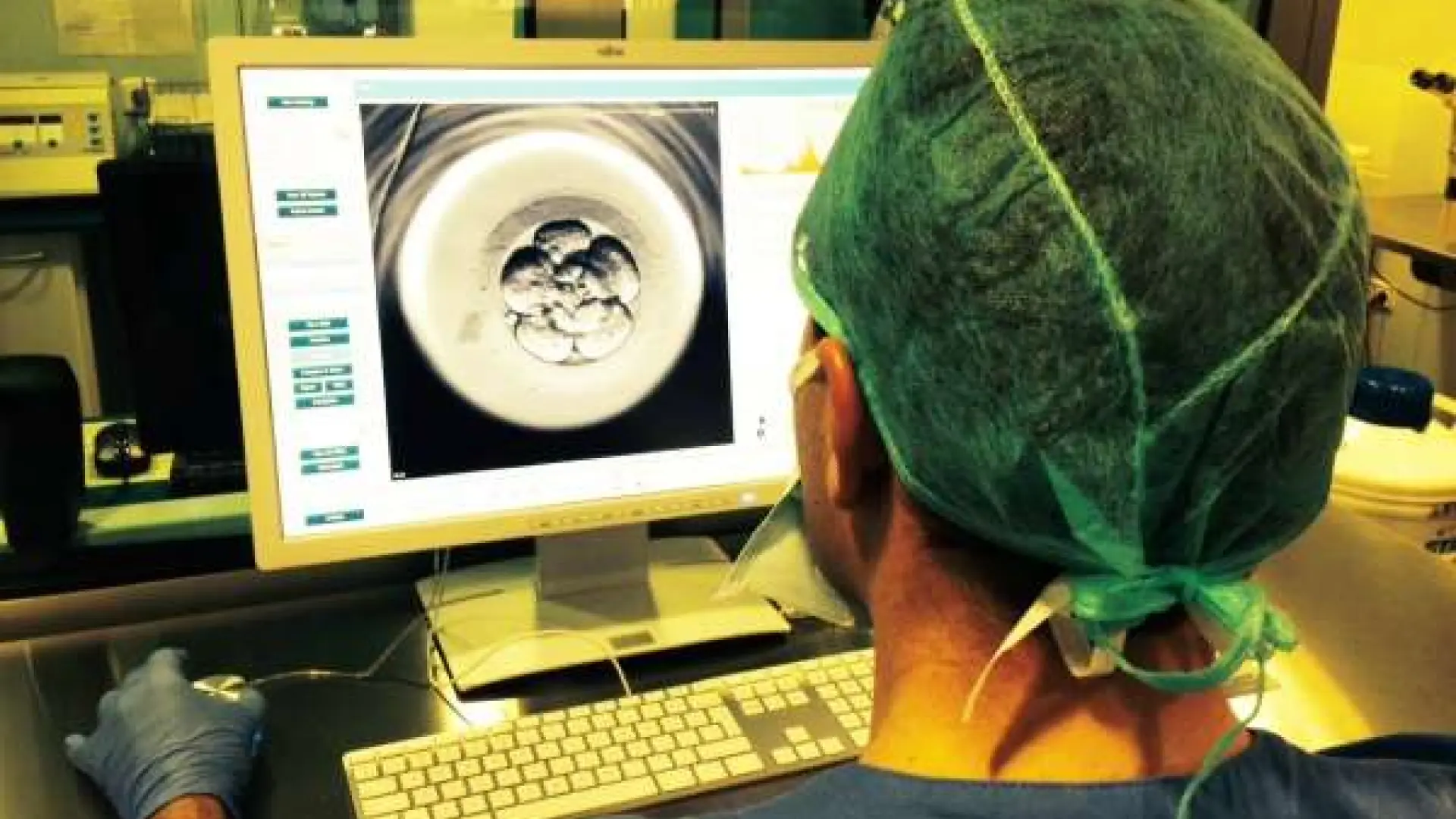 
         Qué se sabe del caso del donante de semen que ha transmitido una enfermedad minoritaria a tres personas en Cataluña 
    