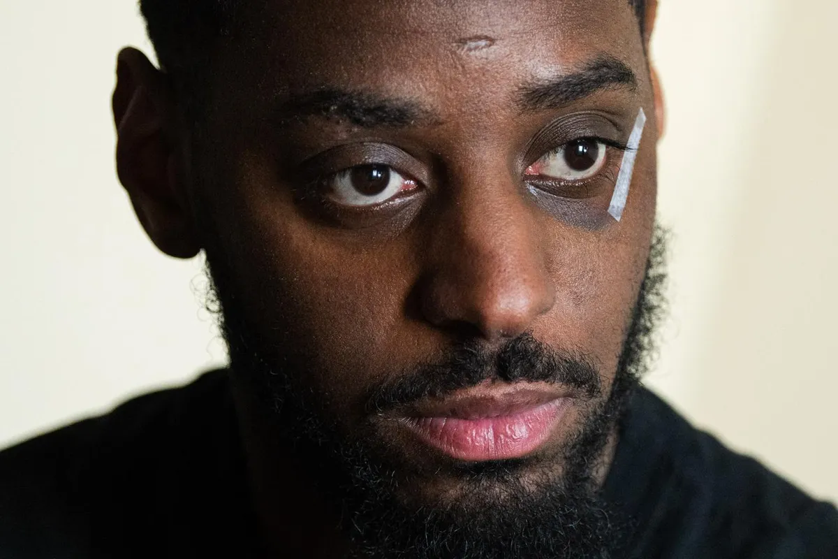 Le témoignage de Flavel, victime de violences policières à Noisiel, dans la nuit du 16 mars : « S’il n’y avait pas eu de vidéos, on ne m’aurait jamais cru »