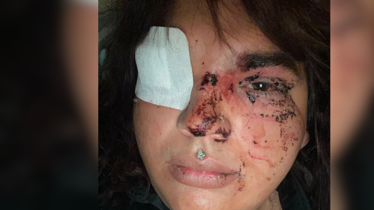 
                                          Una mujer transexual sufre una paliza a manos de un grupo de personas en La Bañeza
                                      