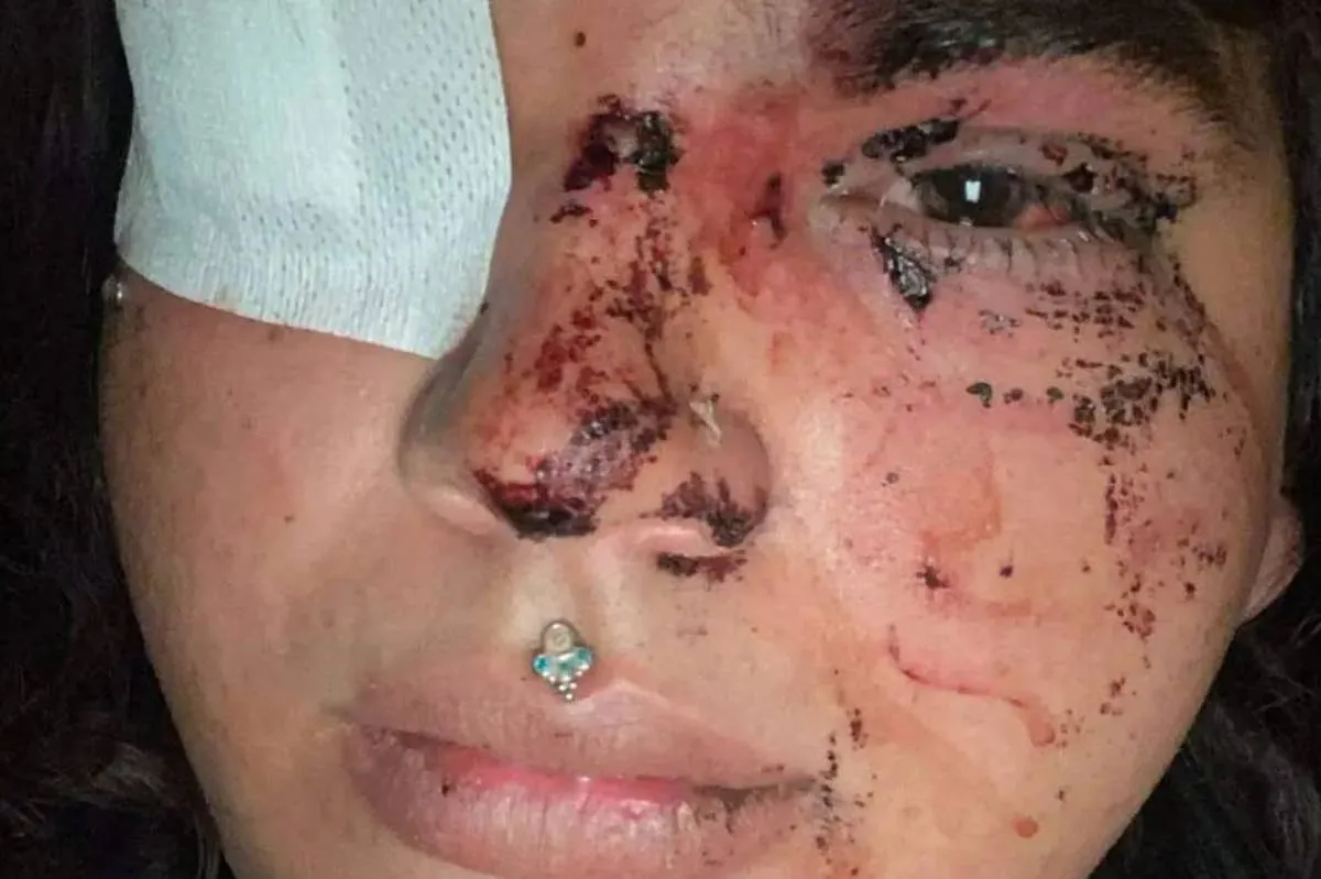 Miss Trans Zamora recibe una paliza en la que "casi pierde un ojo" de un grupo de entre 8 y 10 personas en La Bañeza (León)