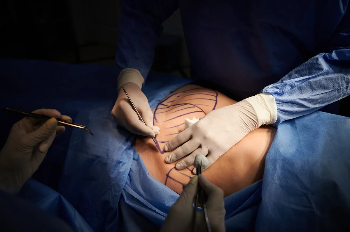 Sanidad veta las cirugías estéticas a los médicos que no tengan la especialidad