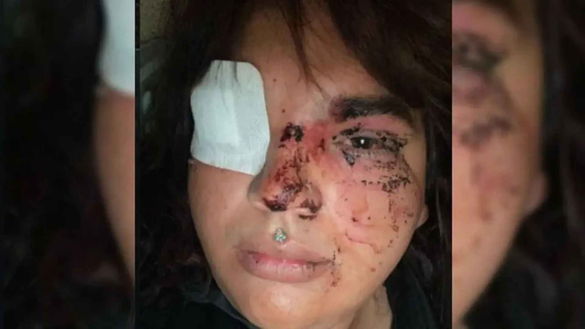 
         El motivo por el que se desencadenó la brutal agresión contra la mujer transexual en La Bañeza 
    