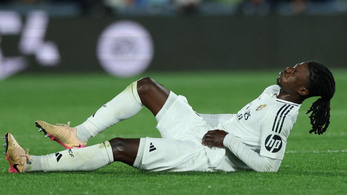Camavinga, como Mbappé: el Madrid también le examinó la pierna equivocada