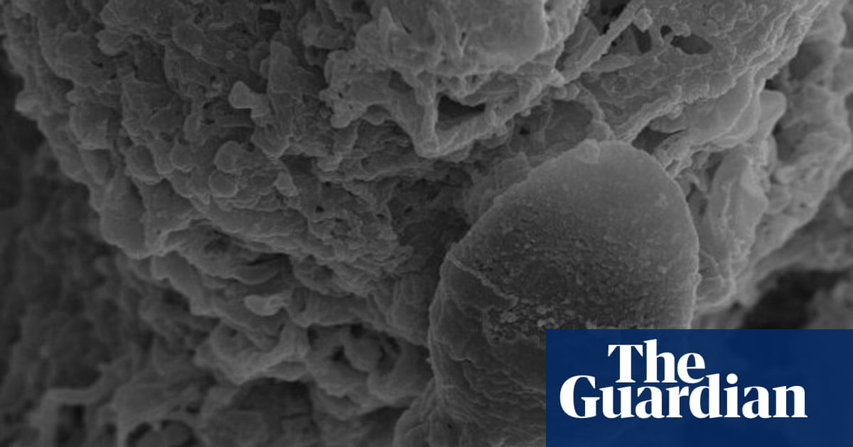 Sperm get lost in space, Australian research into microgravity impacts suggests