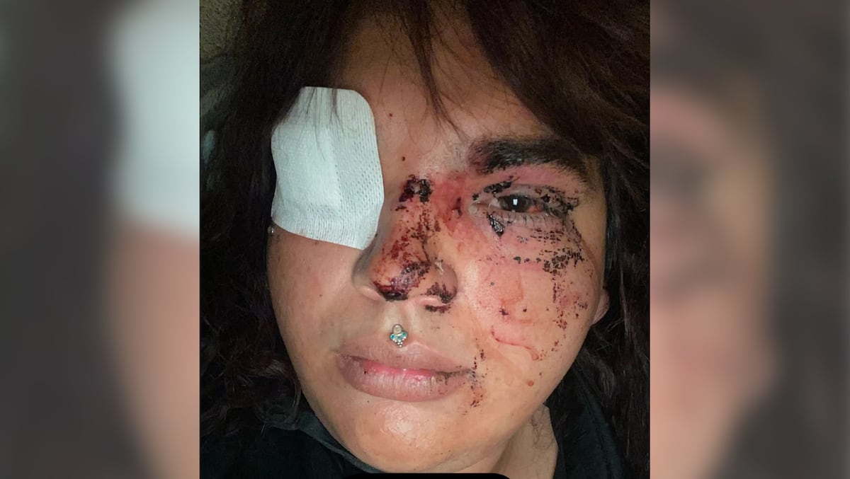 Detenidas cinco mujeres por la agresión tránsfoba ocurrida en un pueblo de León 