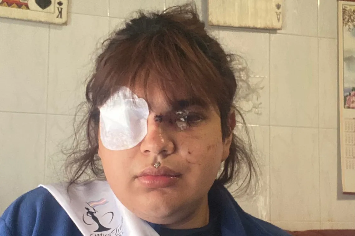 Bianca, Miss Trans Zamora, tras la agresión: "Está todavía con mucho miedo, porque hubo un momento en que se vio muerta"