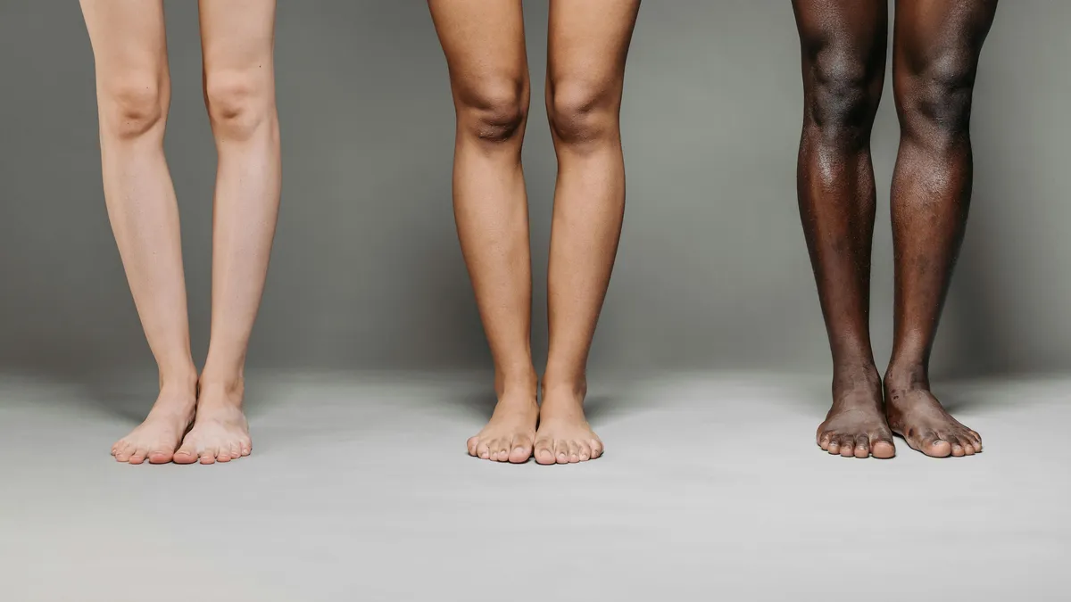 Les peaux noires et foncées sont-elles les grandes oubliées de la dermatologie en France ?