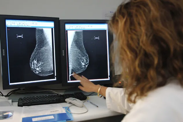 El mapa más detallado de la mama revela por qué la menopausia abre la puerta al cáncer