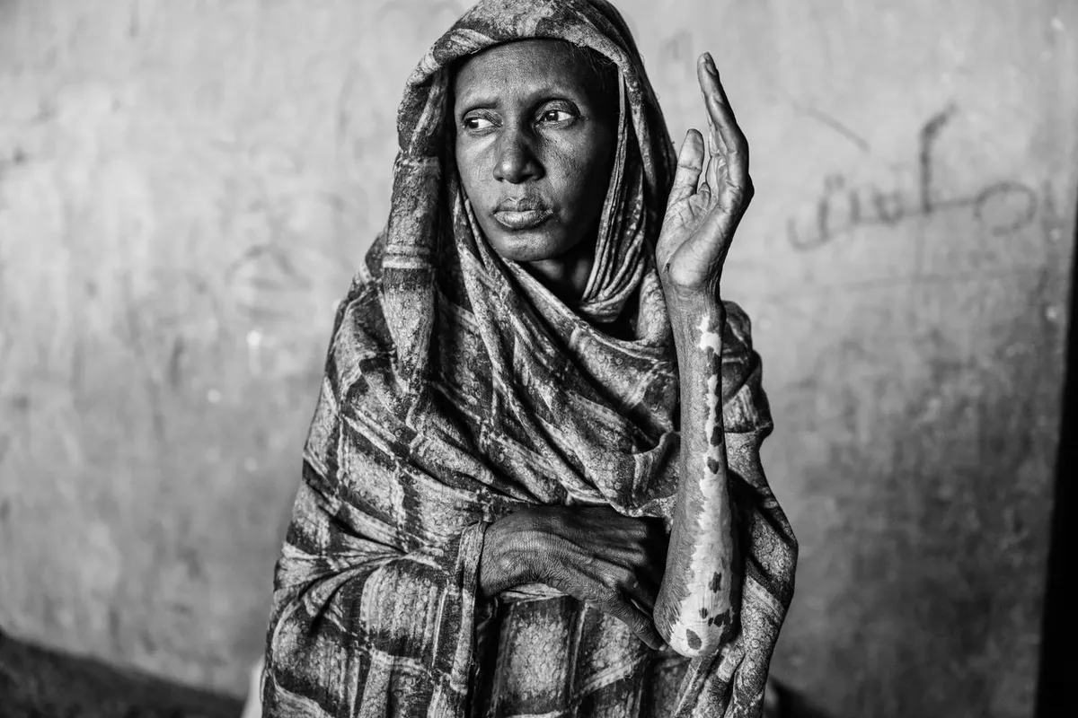 World Press Photo 2026 : Abdulmonam Eassa récompensé pour sa couverture de la guerre au Soudan, pour « Le Monde »