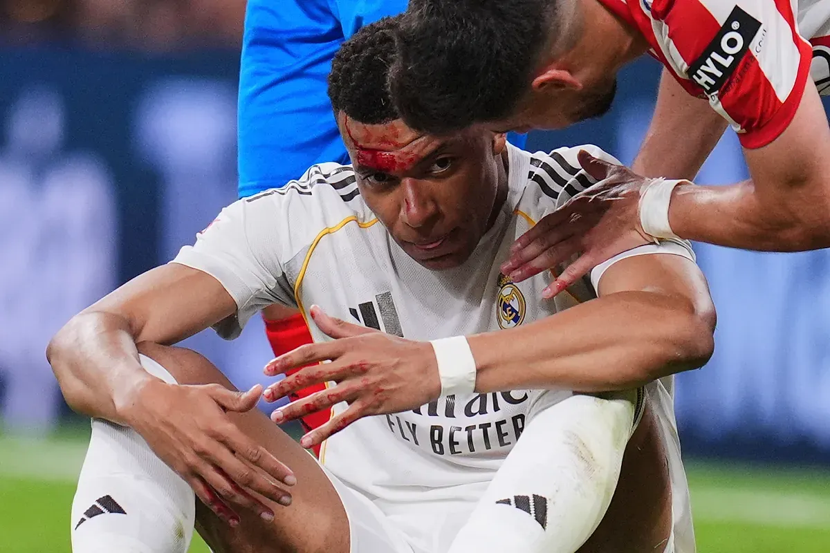 Arbeloa estalla contra los árbitros por el penalti no pitado sobre Mbappé: "Cuando viene bien entra el VAR, y cuando no, no entra"