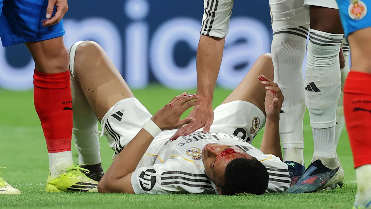 Debatten vor dem Rückspiel: Real reist verwundet nach München