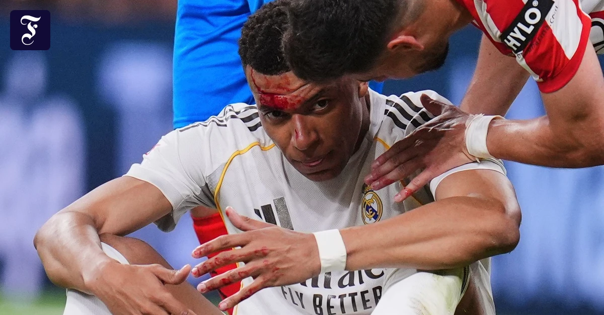 Nach Kopfwunde: Stürmerstar Mbappé wohl fit für Rückspiel gegen Bayern