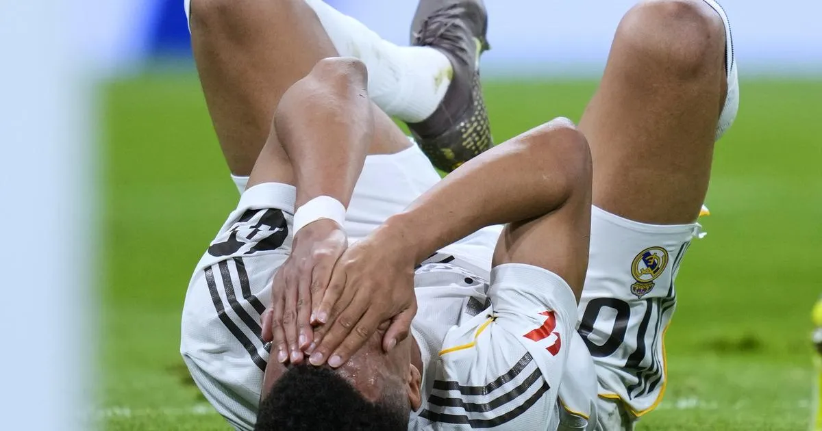 Ligue des champions : face au Bayern, Mbappé portera un gros pansement après sa blessure au visage
