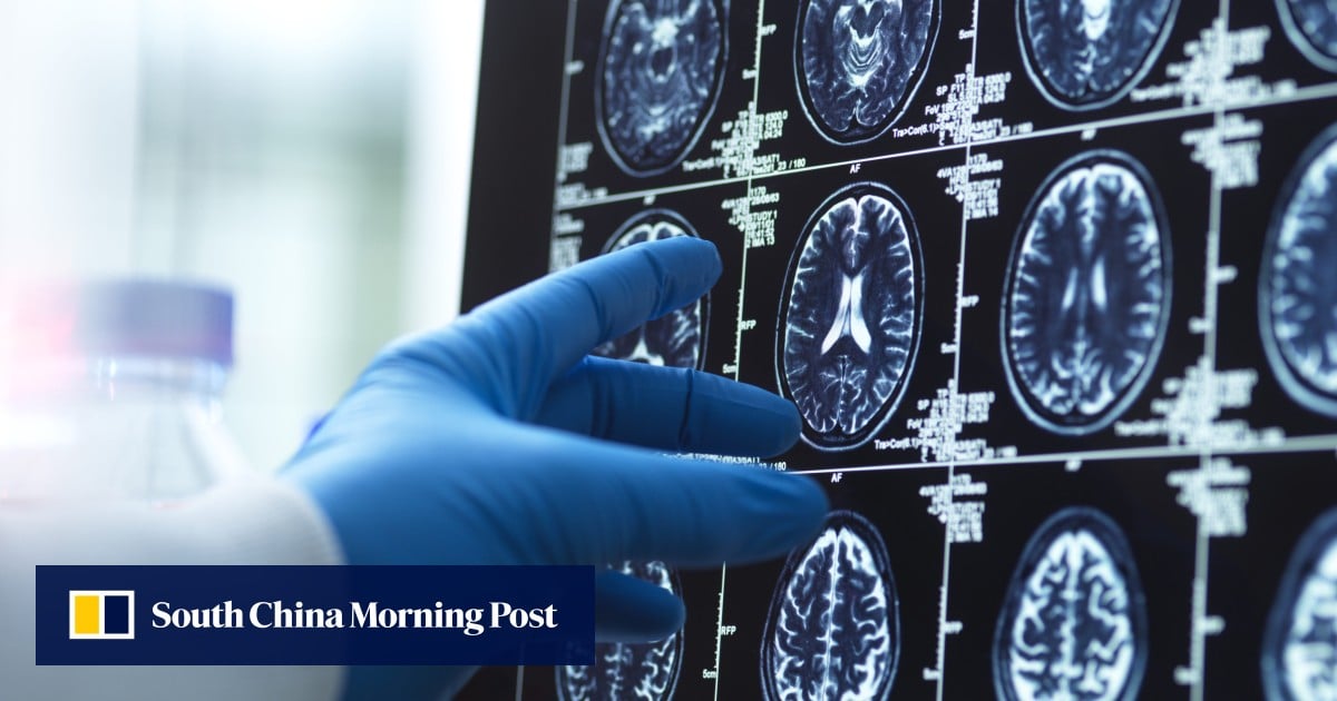 China launches war on Alzheimer’s that may affect 10% of population by 2050