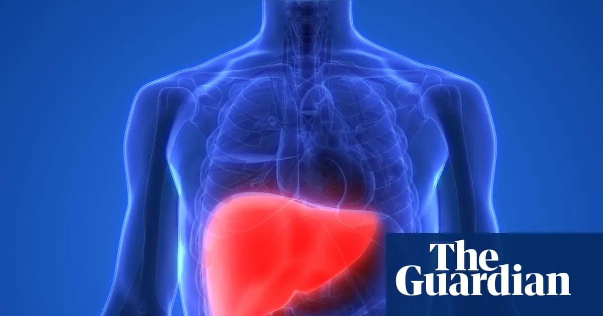 Raise tax on alcohol and junk food to cut deaths from liver disease, experts say