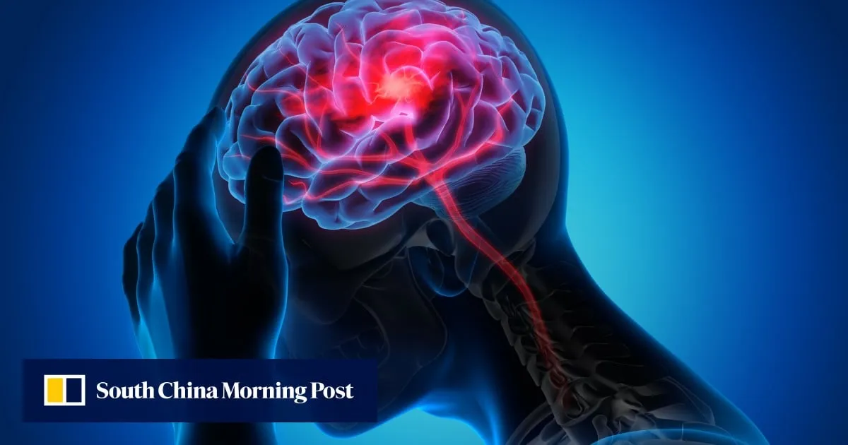 South Korean team behind promising stroke research, treatment cites Chinese interest