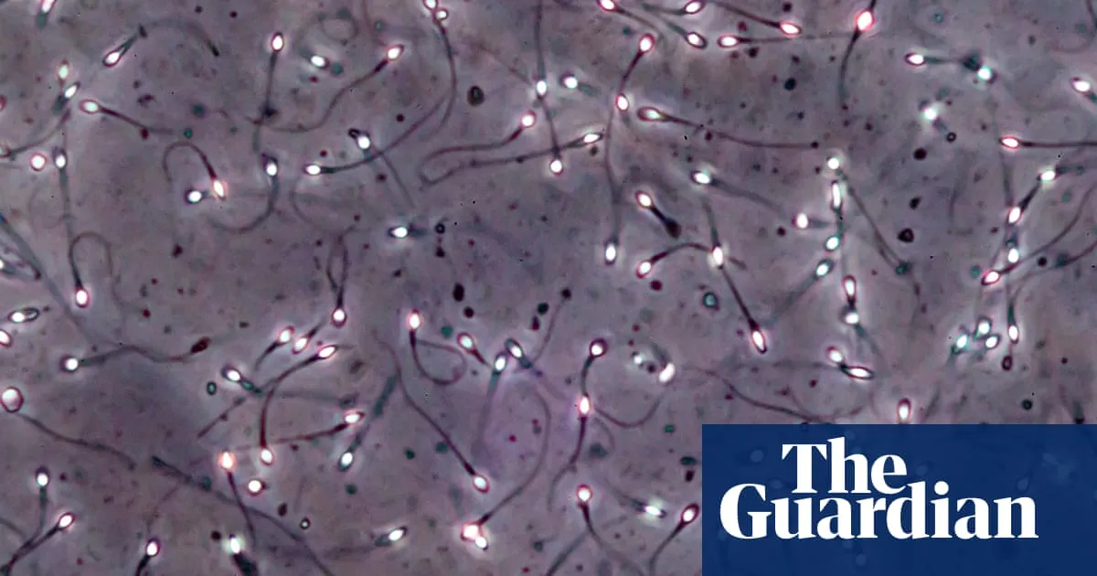 Man produces sperm from testicular tissue frozen as a child in breakthrough trial