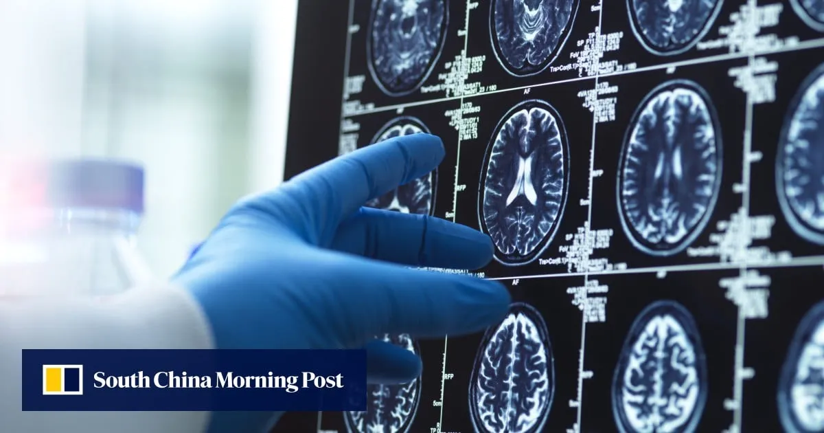 China builds world’s first ‘coal battery’, war on Alzheimer’s: 7 science highlights