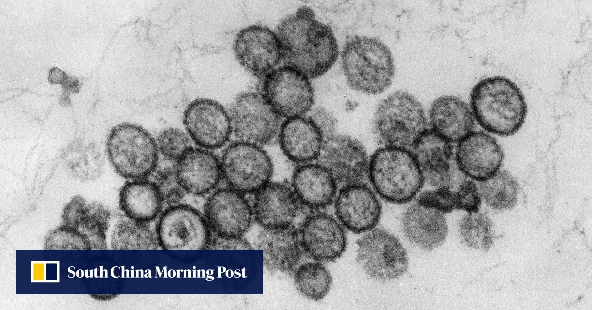 Hong Kong seeks more details from WHO on hantavirus outbreak on cruise ship