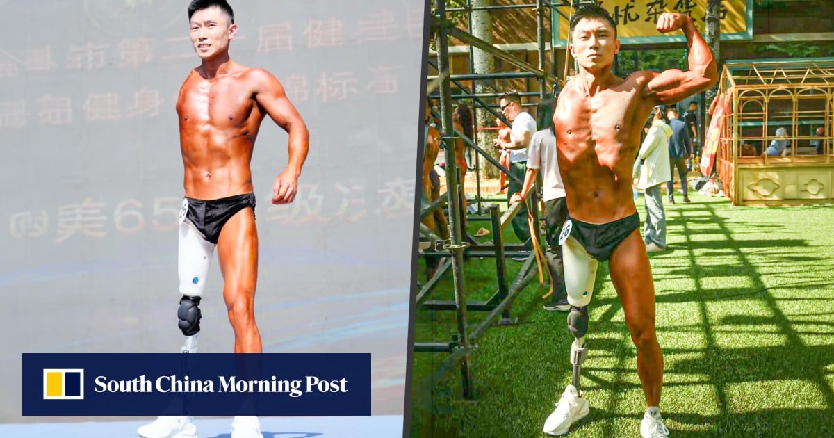 Chinese man who lost a leg and an arm inspires many by competing in bodybuilding