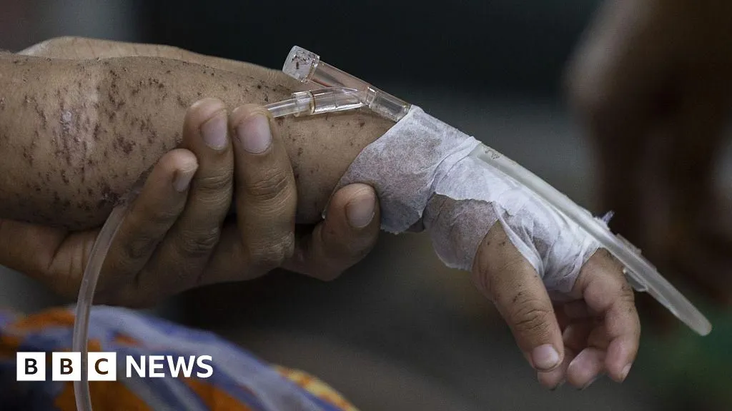 Hundreds of children die within months as measles cases soar in Bangladesh