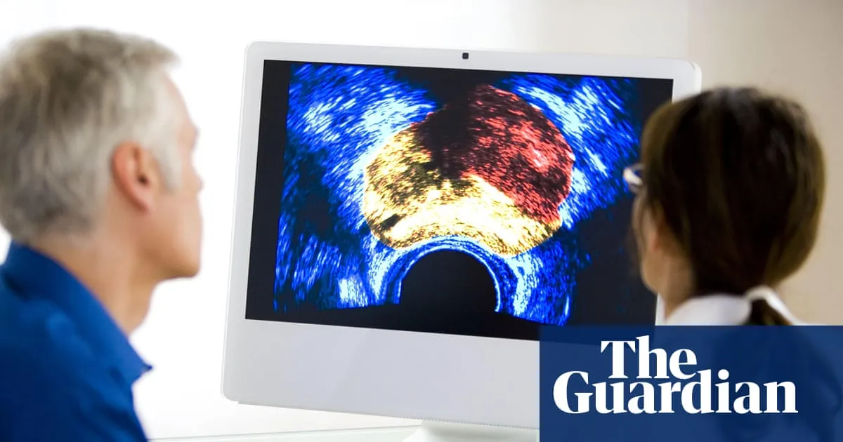 Most UK men should not be offered prostate cancer screening, experts say