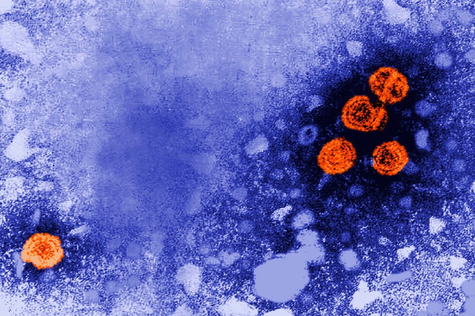 Experimental hepatitis B drug may offer ‘functional cure’ for some patients