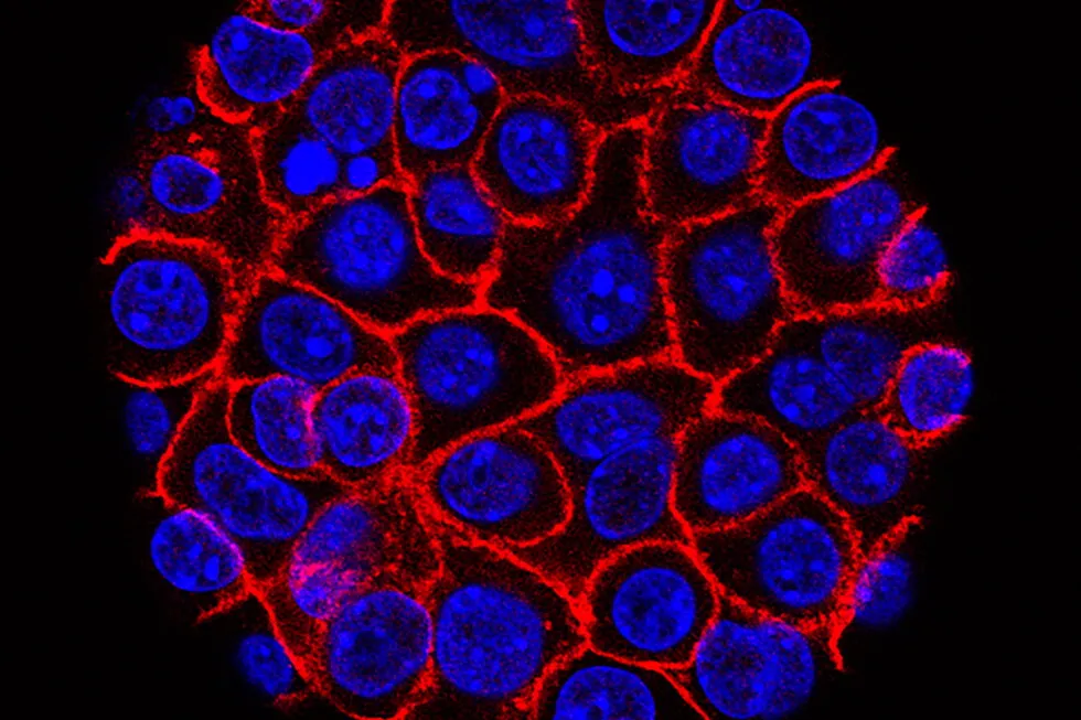 Experimental pill promises new hope for deadly pancreatic cancer
