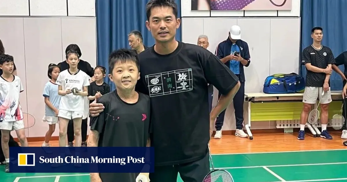 China boy with 97% burns dreams of becoming top badminton player, practises daily despite pain