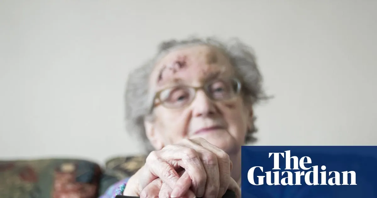 GPs in England too ‘overloaded’ to help older people at risk of falling, say MPs