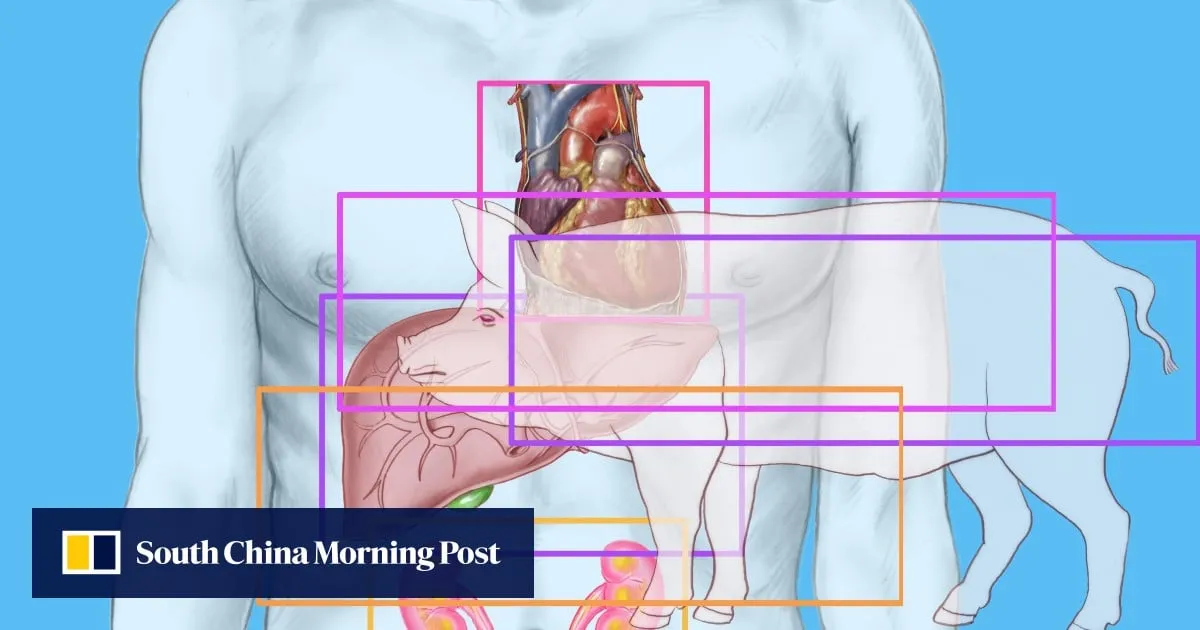 China performs first ever combined transplant of pig liver and kidney to human