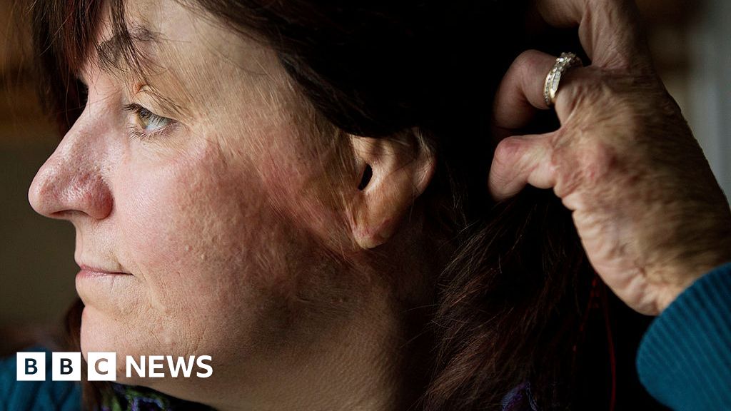 A deadly fire swept through a nightclub in just 90 seconds. I got out