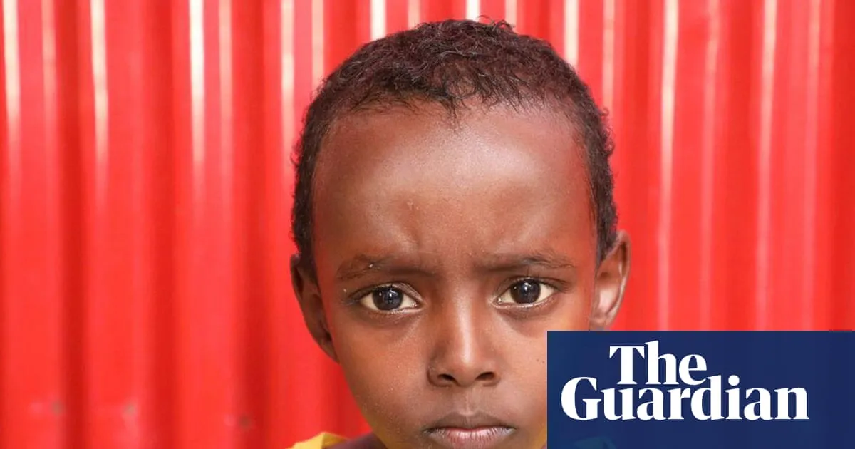 Seven-year-old Abdiqadir was hit in a US airstrike. Without a $750 operation, he may lose his ability to walk