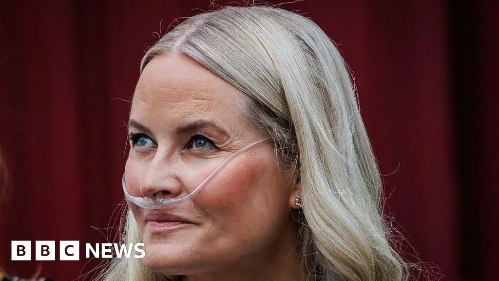 Norway's crown princess undergoes successful lung transplant, palace says