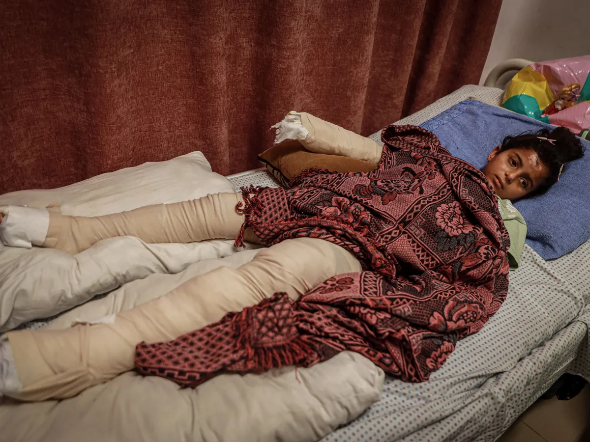 ‘Between pain and fear’: Gaza children bear cost of ongoing Israeli attacks